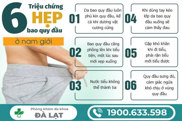 Hình ảnh minh họa